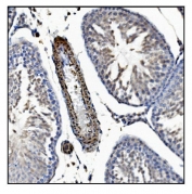 IHC staining of FFPE rat testis tissue with TAGLN antibody. HIER: boil tissue sections in pH8 EDTA for 20 min and allow to cool before testing.