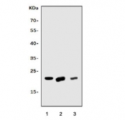 Western blot testing of 1) human HepG2, 2) rat stomach and 3) mouse spleen tissue lysate with TAGLN antibody. Predicted molecular weight ~23 kDa.