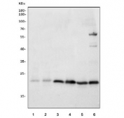 Western blot testing of 1) rat thymus, 2) rat PC-12, 3) mouse brain, 4) mouse spleen, 5) mouse thymus and 6) mouse NIH 3T3 cell lysate with mtTFA antibody. Expected molecular weight: 24~29 kDa.