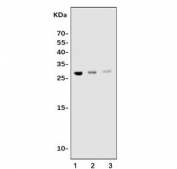 Western blot testing of mouse 1) lung, 2) liver and 3) kidney tissue lysate with Timp1 antibody. Expected molecular weight: 23-28 kDa depending on the level of glycosylation.