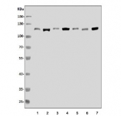 Western blot testing of human 1) HeLa, 2) HEK293, 3) PC-3, 4) COLO-320, 5) HepG2, 6) ThP-1 and 7) A549 cell lysate with XRN2 antibody. Predicted molecular weight ~109 kDa.