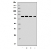 Western blot testing of human 1) HEK293, 2) HeLa, 3) K562 and 4) Caco-2 cell lysate with DAI antibody. Predicted molecular weight: 15-49 kDa (multiple isoforms) but can be observed at up to ~60 kDa.