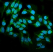 Immunofluorescent staining of FFPE human HeLa cells with DAI antibody (green) and DAPI nuclear stain (blue). HIER: steam section in pH6 citrate buffer for 20 min.