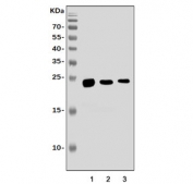 Western blot testing of 1) rat brain, 2) rat kidney and 3) mouse kidney tissue lysate with Aquaporin 1 antibody. Expected molecular weight: 23-28 kDa.