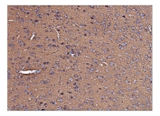 IHC staining of FFPE rat brain tissue with Antizyme inhibitor 2 antibody. HIER: boil tissue sections in pH8 EDTA for 20 min and allow to cool before testing.
