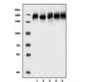 Western blot testing of 1) human Jurkat, 2) human K562, 3) human HEK293, 4) rat brain and 5) mouse brain tissue lysate with Breakpoint cluster region protein antibody. Expected molecular weight: 130-190 kDa (multiple isoforms).