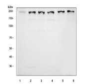 Western blot testing of 1) rat brain and 2) mouse brain tissue lysate with BRD4 antibody. Predicted molecular weight ~156 kDa (long form), but has been observed at 200+ kDa.