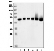 Western blot testing of 1) rat heart, 2) rat kidney, 3) rat liver, 4) mouse heart, 5) mouse kidney and 6) mouse liver tissue lysate with Cd147 antibody. Expected molecular weight: 27-66 kDa depending on level of glycosylation.