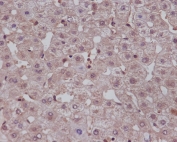 IHC staining of FFPE human liver tissue with NOTCH1 antibody.