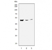 Western blot testing of mouse 1) liver, 2) pancreas, and 3) stomach tissue lysate with Caspase 9 antibody. Expected molecular weight: 45-50 kDa (pro form).