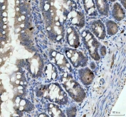 IHC staining of FFPE rat colon tissue with Chromogranin A antibody. HIER: boil tissue sections in pH8 EDTA for 20 min and allow to cool before testing.