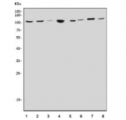 Western blot testing of 1) rat brain, 2) rat liver, 3) rat heart, 4) rat kidney, 5) mouse brain, 6) mouse liver, 7) mouse heart and 8) mouse kidney tissue lysate with CLCN5 antibody. Expected molecular weight: 80-83 kDa (isoform 2) and 90-100 kDa (isoform 1).