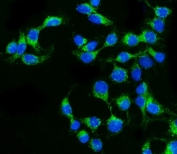 Immunofluorescent staining of FFPE human Caco-2 cells with Claudin 2 antibody (green) and DAPI nuclear stain (blue). HIER: steam section in pH6 citrate buffer for 20 min.