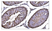 IHC staining of FFPE rat testis tissue with CAMKIV antibody. HIER: boil tissue sections in pH8 EDTA for 20 min and allow to cool before testing.