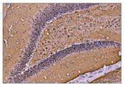 IHC staining of FFPE rat brain tissue with CAMKIV antibody. HIER: boil tissue sections in pH8 EDTA for 20 min and allow to cool before testing.