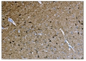 IHC staining of FFPE mouse brain tissue with CAMKIV antibody. HIER: boil tissue sections in pH8 EDTA for 20 min and allow to cool before testing.
