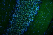 Immunofluorescent staining of FFPE rat cerebellum tissue with CAMKIV antibody (green) and DAPI nuclear stain (blue). HIER: steam section in pH6 citrate buffer for 20 min.