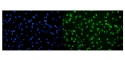 Immunofluorescent staining of FFPE mouse RM-1 cells with CAMKIV antibody (green) and DAPI nuclear stain (blue). HIER: steam section in pH6 citrate buffer for 20 min.