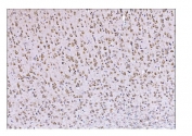 IHC staining of FFPE rat brain tissue with DLGAP1 antibody. HIER: boil tissue sections in pH8 EDTA for 20 min and allow to cool before testing.