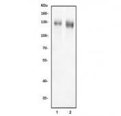 Western blot testing of 1) rat brain and 2) mouse brain tissue lysate with DLGAP1 antibody. Predicted molecular weight ~109 kDa but can be observed at up to ~130 kDa.