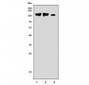 Western blot testing of 1) rat brain, 2) mouse brain and 3) mouse NIH 3T3 cell lysate with Dynamin 3 antibody. Expected molecular weight ~100 kDa.