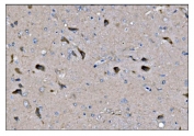 IHC staining of FFPE rat brain tissue with Dynamin 3 antibody. HIER: boil tissue sections in pH8 EDTA for 20 min and allow to cool before testing.