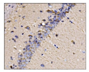 IHC staining of FFPE mouse brain tissue with Dynamin 3 antibody. HIER: boil tissue sections in pH8 EDTA for 20 min and allow to cool before testing.