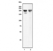 Western blot testing of 1) rat liver and 2) mouse liver tissue lysate with Duox2 antibody. Predicted molecular weight ~175 kDa.