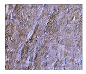 IHC staining of FFPE human skeletal muscle tissue with DYSF antibody. HIER: boil tissue sections in pH8 EDTA for 20 min and allow to cool before testing.