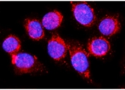 Immunofluorescent staining of FFPE human SiHa cells with PAST1 antibody (red) and DAPI nuclear stain (blue). HIER: steam section in pH6 citrate buffer for 20 min.