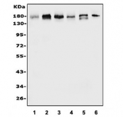 Western blot testing of human 1) PC-3, 2) HEK293, 3) U-87 MG, 4) A549, 5) U-2 OS and 6) rat testis lysate with EHMT2 antibody. Expected molecular weight: 160-180 kDa.