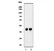 Western blot testing of 1) rat C6 and 2) mouse NIH 3T3 cell lysate with Elovl4 antibody. Predicted molecular weight ~37 kDa.