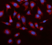 Immunofluorescent staining of FFPE mouse RM-1 cells with Elovl4 antibody (red) and DAPI nuclear stain (blue). HIER: steam section in pH6 citrate buffer for 20 min.