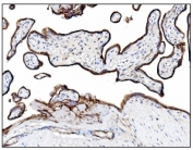IHC staining of FFPE human placental tissue with CD39 antibody. HIER: boil tissue sections in pH8 EDTA for 20 min and allow to cool before testing.