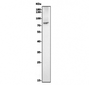 Western blot testing of human placental tissue lysate with CD39 antibody. Expected molecular weight: 34-100 kDa depending on isoform and level of glycosylation.