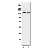 Western blot testing of human 1) Jurkat and 2) Caco-2 cell lysate with ERAP2 antibody. Predicted molecular weight ~110 kDa.