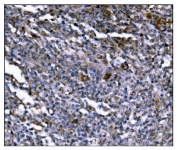 IHC staining of FFPE human lymphoma tissue with ERAP2 antibody. HIER: boil tissue sections in pH8 EDTA for 20 min and allow to cool before testing.
