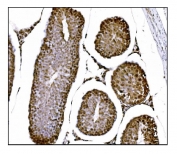 IHC staining of FFPE rat testis tissue with FTO antibody. HIER: boil tissue sections in pH8 EDTA for 20 min and allow to cool before testing.