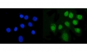 Immunofluorescent staining of FFPE human SiHa cells with FTO antibody (green) and DAPI nuclear stain (blue). HIER: steam section in pH6 citrate buffer for 20 min.