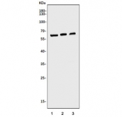 Western blot testing of human 1) U-87 MG, 2) HEK293 and 3) HeLa cell lysate with FTO antibody. Predicted molecular weight ~58 kDa.