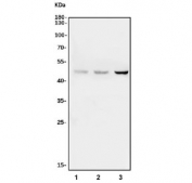 Western blot testing of 1) rat stomach, 2) rat testis and 3) mouse testis tissue lysate with Histone acetyltransferase 1 antibody. Predicted molecular weight: 50 kDa (isoform a).