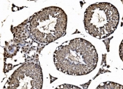 IHC staining of FFPE mouse testis tissue with HDAC2 antibody. HIER: boil tissue sections in pH8 EDTA for 20 min and allow to cool before testing.