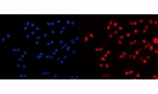 Immunofluorescent staining of FFPE human Caco-2 cells with HDAC2 antibody (red) and DAPI nuclear stain (blue). HIER: steam section in pH6 citrate buffer for 20 min.