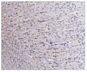IHC staining of FFPE rat brain tissue with Neurofilament-66 antibody. HIER: boil tissue sections in pH8 EDTA for 20 min and allow to cool before testing.
