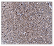 IHC staining of FFPE mouse brain tissue with Neurofilament-66 antibody. HIER: boil tissue sections in pH8 EDTA for 20 min and allow to cool before testing.