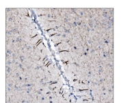 IHC staining of FFPE mouse brain tissue with Neurofilament-66 antibody. HIER: boil tissue sections in pH8 EDTA for 20 min and allow to cool before testing.