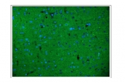 Immunofluorescent staining of FFPE rat brain tissue with Neurofilament-66 antibody (green) and DAPI nuclear stain (blue). HIER: steam section in pH6 citrate buffer for 20 min.