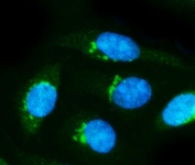 Immunofluorescent staining of FFPE human SiHa cells with Neurofilament-66 antibody (green) and DAPI nuclear stain (blue). HIER: steam section in pH6 citrate buffer for 20 min.