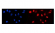 Immunofluorescent staining of FFPE human Caco-2 cells with TCF1 alpha antibody (red) and DAPI nuclear stain (blue). HIER: steam section in pH6 citrate buffer for 20 min.