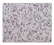 IHC staining of FFPE rat brain tissue with LRP1B antibody. HIER: boil tissue sections in pH8 EDTA for 20 min and allow to cool before testing.